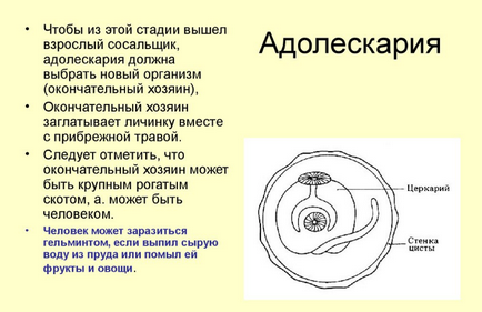 Печінковий сисун - цикл розвитку, симптоми, лікування