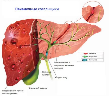 Печінковий сисун - життєвий цикл