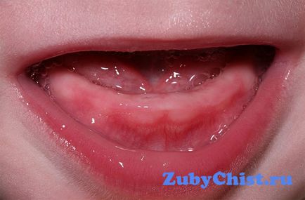 Порядок прорізування молочних зубів у дітей