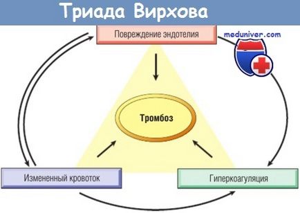 Cauzele trombozei și hipercoagulabilității