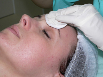 Metode dovedite pentru eliminarea urmei de acnee pe spate - opțiuni pentru tratarea petelor și cicatricilor