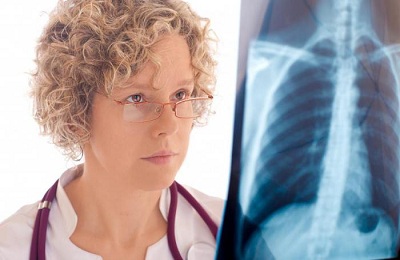 Radiografia cancerului pulmonar ca metastazele arata si va X-ray arata o tumora