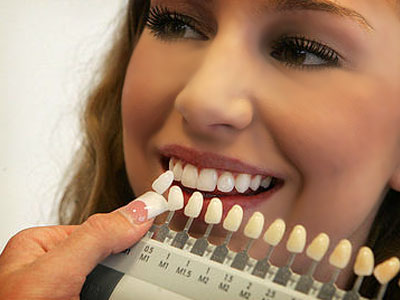 Реставрація передніх зубів який вид протезування вибрати