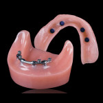 Знімні зубні протези, стоматологічна клініка