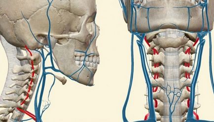 Sindromul arterei vertebrale cu simptome și tratament pentru osteochondroza cervicală