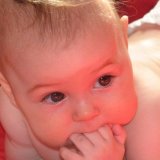 West-szindróma klinika, diagnosztika, kezelés - szike - egészségügyi tájékoztatás és oktatás (diagnosztika) West-szindróma klinika, diagnosztika, kezelés - szike - Orvosi Információs és Oktatási