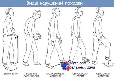 Съвети за оценка на мускулния тонус и мускулната сила