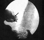 A modern technológia a sebészi kezelése achalasia II-III szakasz - cikkek