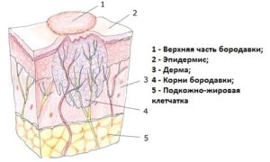 Totul despre structura negilor - fotografie, rădăcină, structură