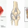 Basalioma tratament folcloric