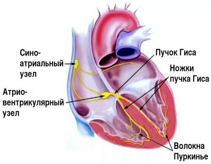 Блокада серця - види, причини, симптоми, діагностика, лікування та наслідки