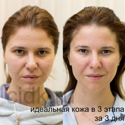 Központi Intézet Bőrgyógyászati és kozmetológiai (Központi Intézet Bőrgyógyászati és kozmetológiai) Központi Intézet Bőrgyógyászati és kozmetológiai