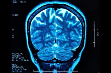 Mi a különbség a CT agyi MRI az agy jobb (különbség)