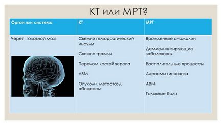 Mi a különbség a CT MRI az agyi erek, akkor jobb, ha