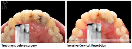 Fogászati implantáció, Denis Nikolaevich Jakovlev, fogorvos (fogorvos) Fogászati implantáció, Denis Nikolaevich Yakovlev, fogorvos