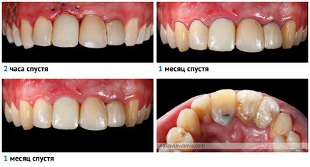 Implantul dentar, yakovlev denis Nikolaevich, dentist