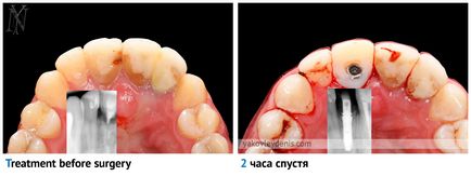 Implantul dentar, yakovlev denis Nikolaevich, dentist