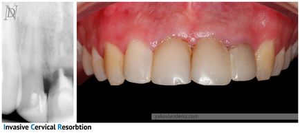 Implantul dentar, yakovlev denis Nikolaevich, dentist