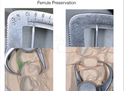 Dental-revü, cikkek, ortopédiai megközelítés