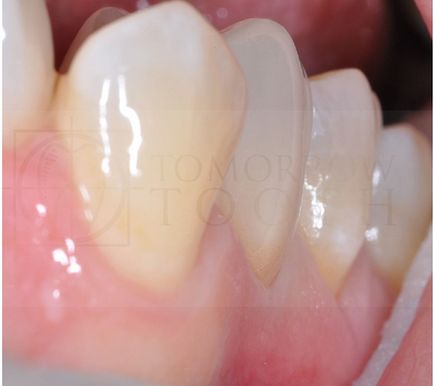 Dental-revü, cikkek, ortopédiai megközelítés