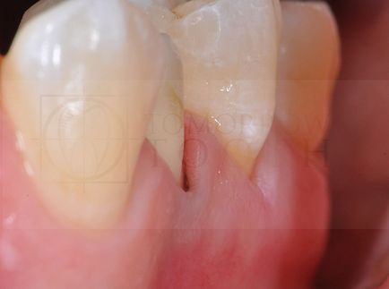 Revizie dentară, articole, abordare ortopedică