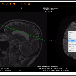 Dicom pe site-ul de descărcare și vizualizare, portalul radiologilor