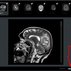 Dicom pe site-ul de descărcare și vizualizare, portalul radiologilor