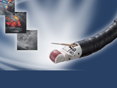 Endoscopie - centru medical 