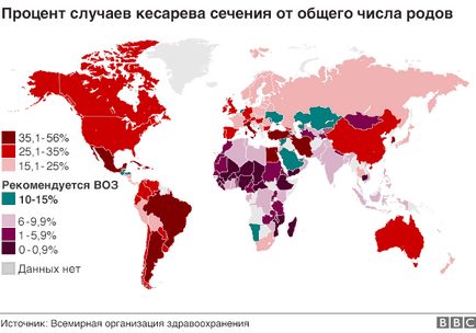 Це не пологи