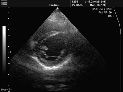 Echocardiografia (cauze cardiale și zgomote în inimă) - m. Pescarilor