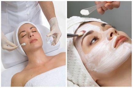 Indicații de peeling glicolic, contraindicații, beneficii