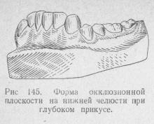 Adâncitură, stomatologie ortopedică