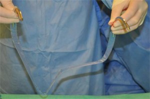 Tratamentul inovator al incontinenței urinare - bucla tvt