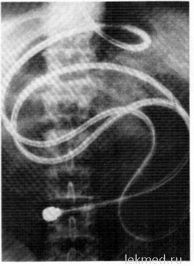 Intestinoscopy - Útmutató klinikai endoszkópos