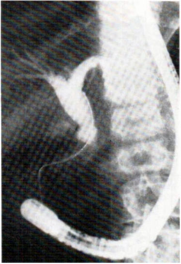 Intestinoscopy - Útmutató klinikai endoszkópos