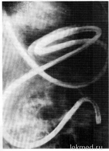 Intestinoscopy - Útmutató klinikai endoszkópos