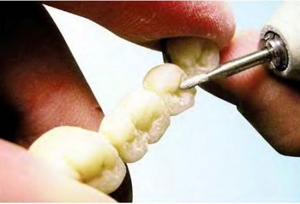 Як роблять зуби (цікаво) - джерело гарного настрою