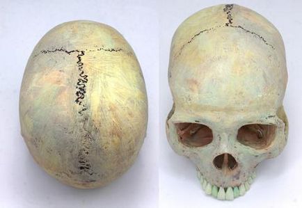 Cum cusatura craniului variaza odata cu varsta