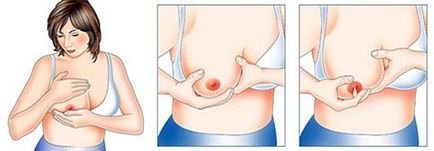 Як правильно зціджувати грудне молоко руками, масаж грудей перед сцеживанием