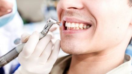 Кисневе відбілювання зубів - показання та протипоказання, процес