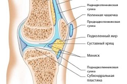 Chistul articulației genunchiului cauzează dezvoltarea spondilită anchilozantă, simptome și tratament (video)