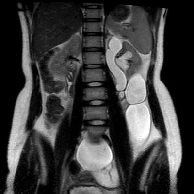 CT és az MRI a betegségek diagnosztizálása a húgyúti, Pediatric Research Institute