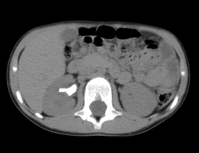 CT és az MRI a betegségek diagnosztizálása a húgyúti, Pediatric Research Institute