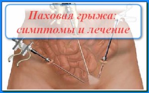 Tratamentul herniei inghinale la bărbați fără intervenție chirurgicală