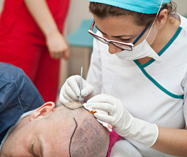 Medicație de păr minoxidil, regeyn, finoksidil