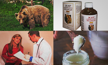 Bear zsír a gyomorfekély és gyomorhurut kezelésére (fekély) Bear zsírt gyomorfekély és gyomorhurut kezelésére