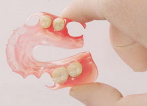 Protezele dentare - invizibilul zâmbetului tău uimitor - despre corecția mușcăturilor și a bretelelor