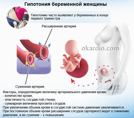 Низький тиск при вагітності причини, симптоми, що робити