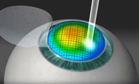 Clinica oftalmologică 
