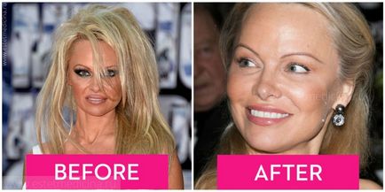 Pamela Anderson 2017